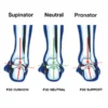 FOOT TYPES FOR CHOOSING THE RIGHT INSOLE SUPPORT