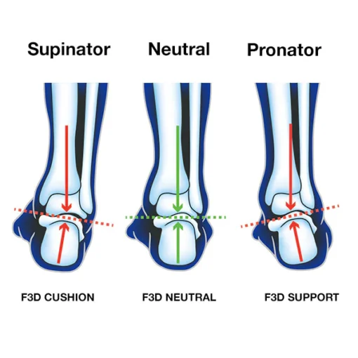FOOT TYPES FOR CHOOSING THE RIGHT INSOLE SUPPORT