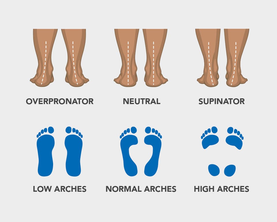 three main pronation patterns